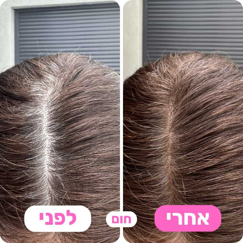 מארז 4 אבקות לכיסוי שורשי השיער - פרימיום