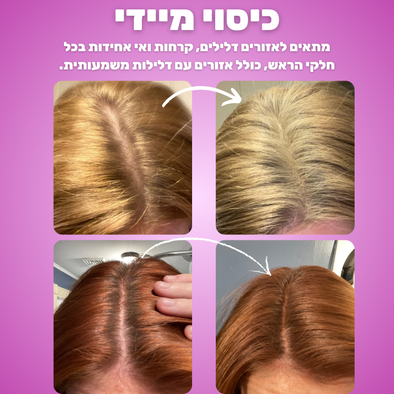 ערכת 2 אבקות GLOW לכיסוי שורשי השיער