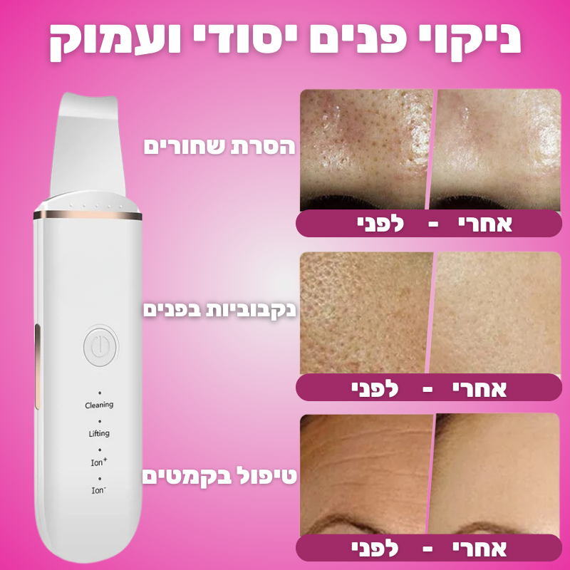 מכשיר לניקוי פנים עמוק והסרת שחורים מבית Glow