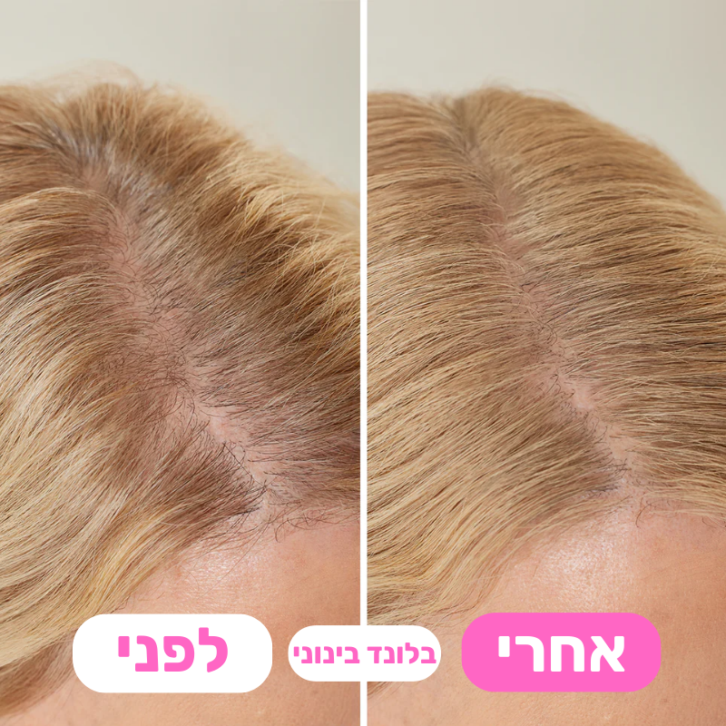 מארז 4 אבקות לכיסוי שורשי השיער - פרימיום